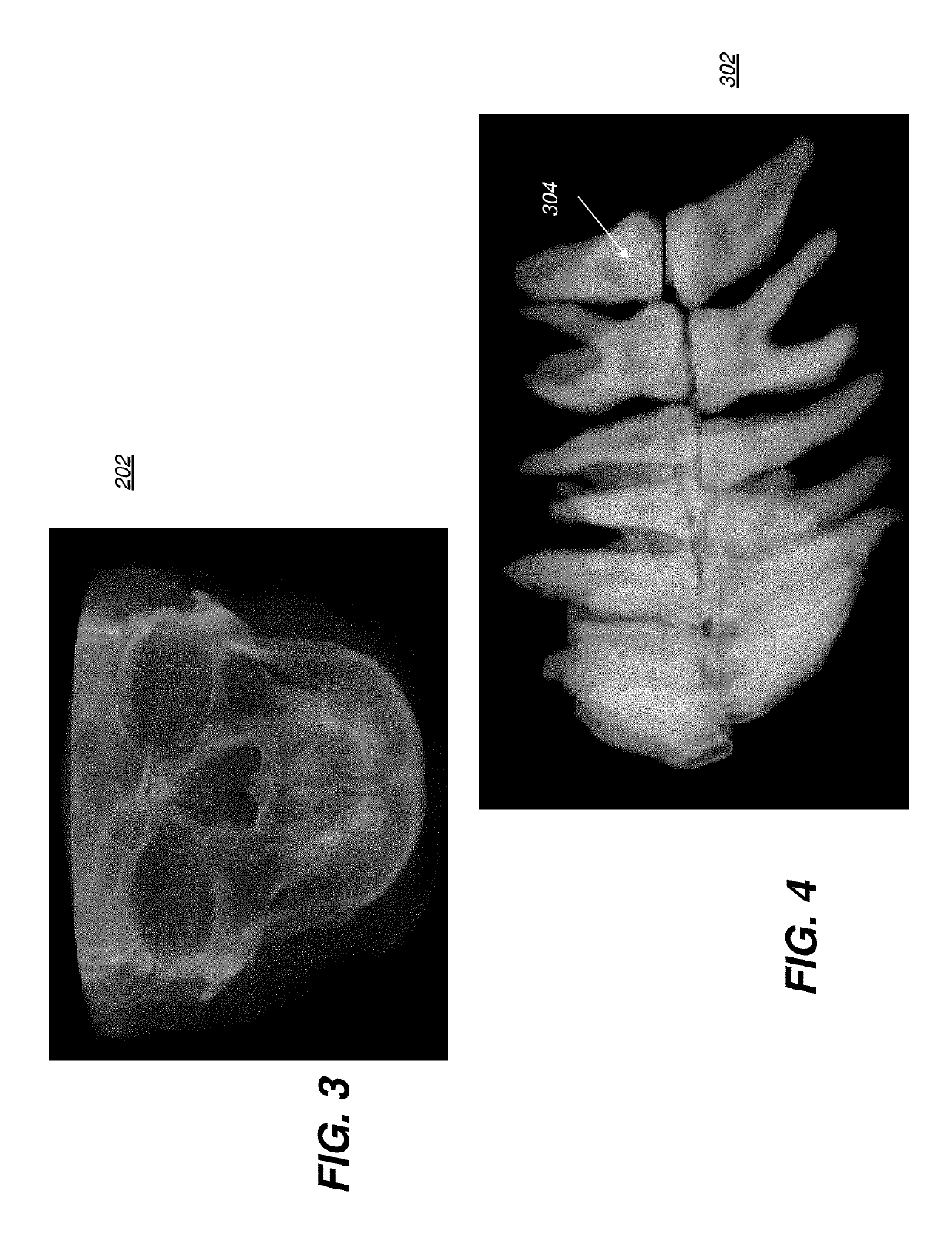 Method for cephalometric analysis