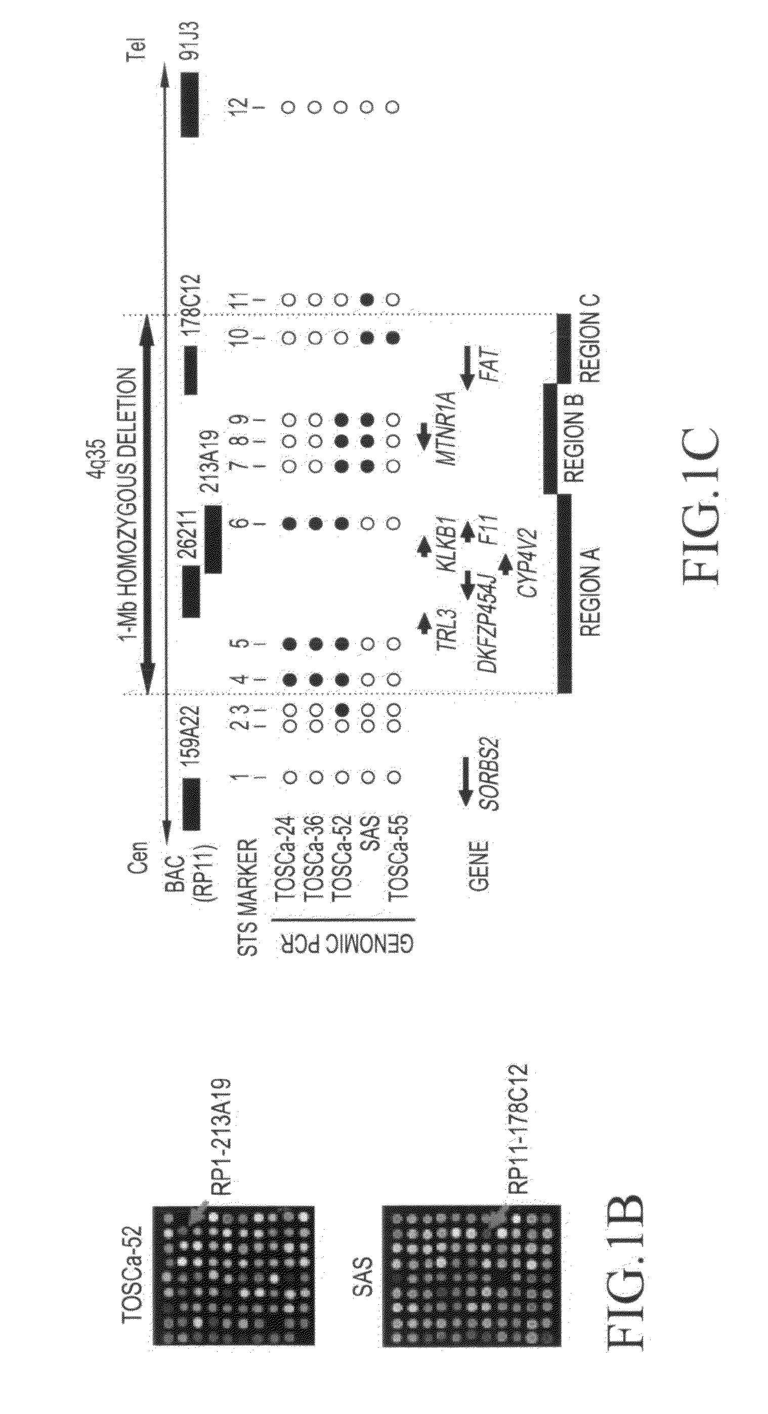 Method for detecting oral squamous-cell carcinoma