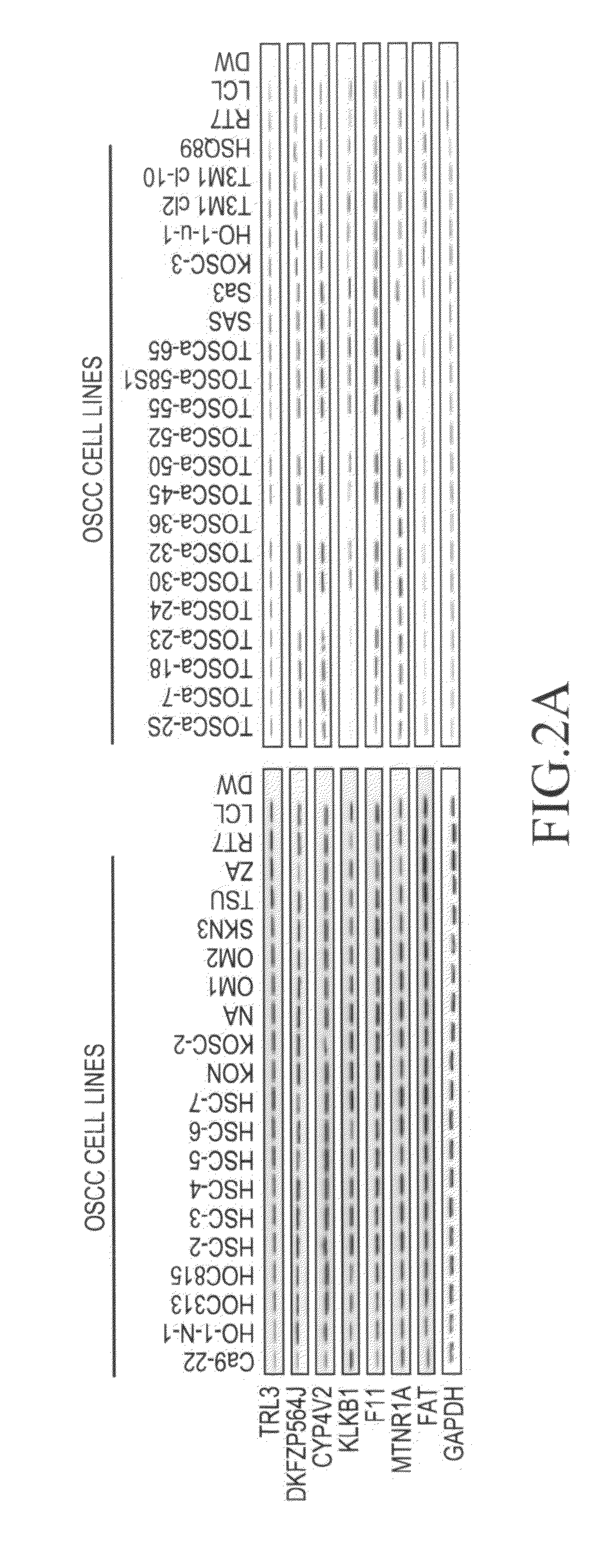 Method for detecting oral squamous-cell carcinoma