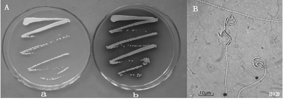 Streptomyces katrae NB20, as well as culture method and application thereof