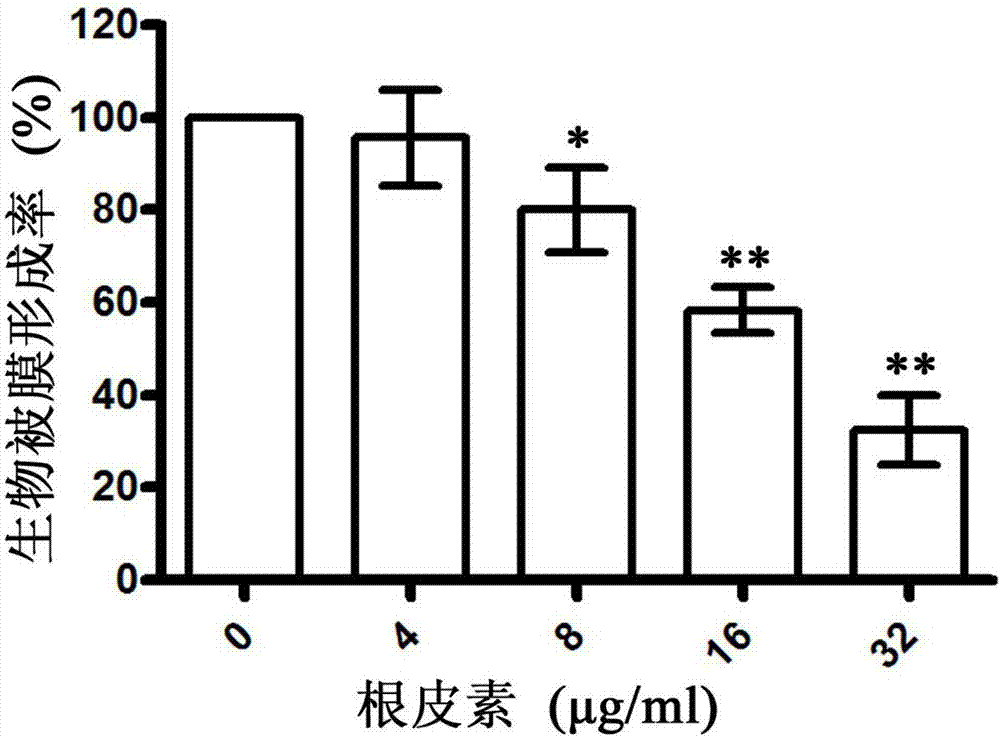 Application of phloretin in preparation of medicine for treating chicken necrotic enteritis