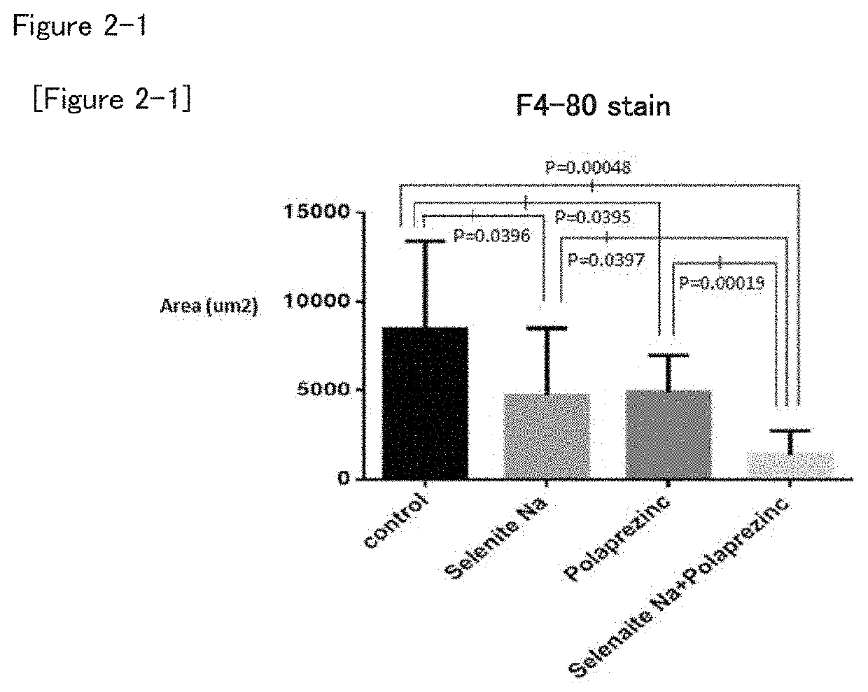 Method for treating non-alcoholic steatohepatitis (NASH) with the combination of polaprezinc and sodium selenite