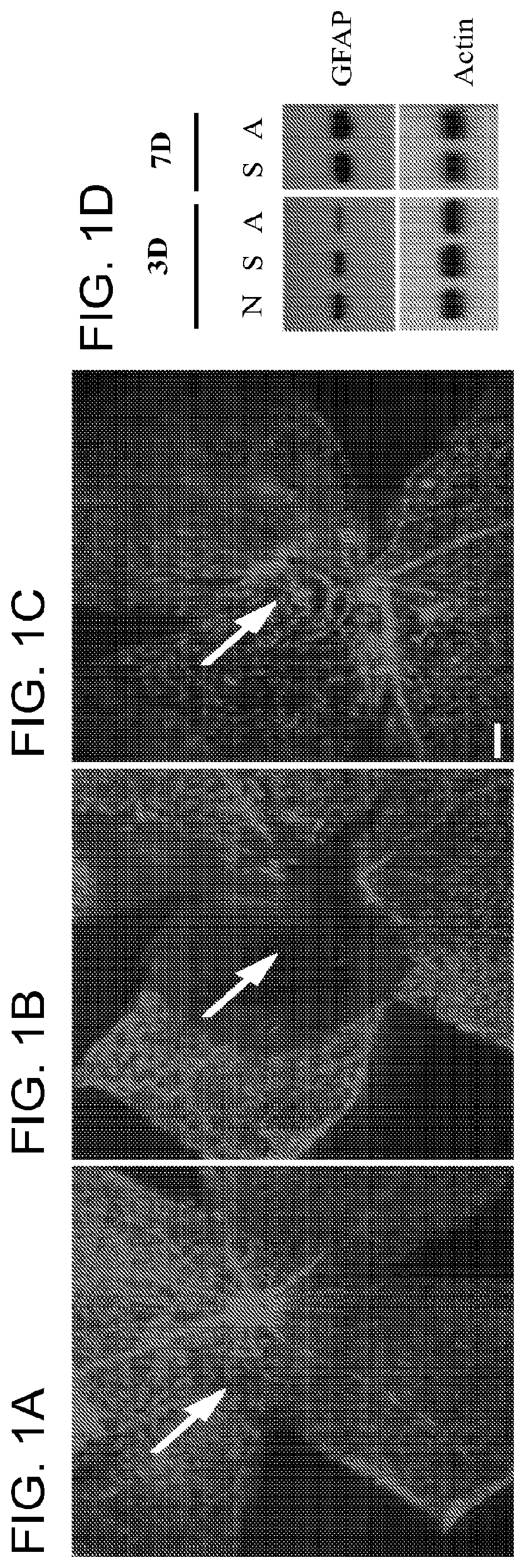 Alpha-aminoadipate for treatment of vision loss and restoring sight