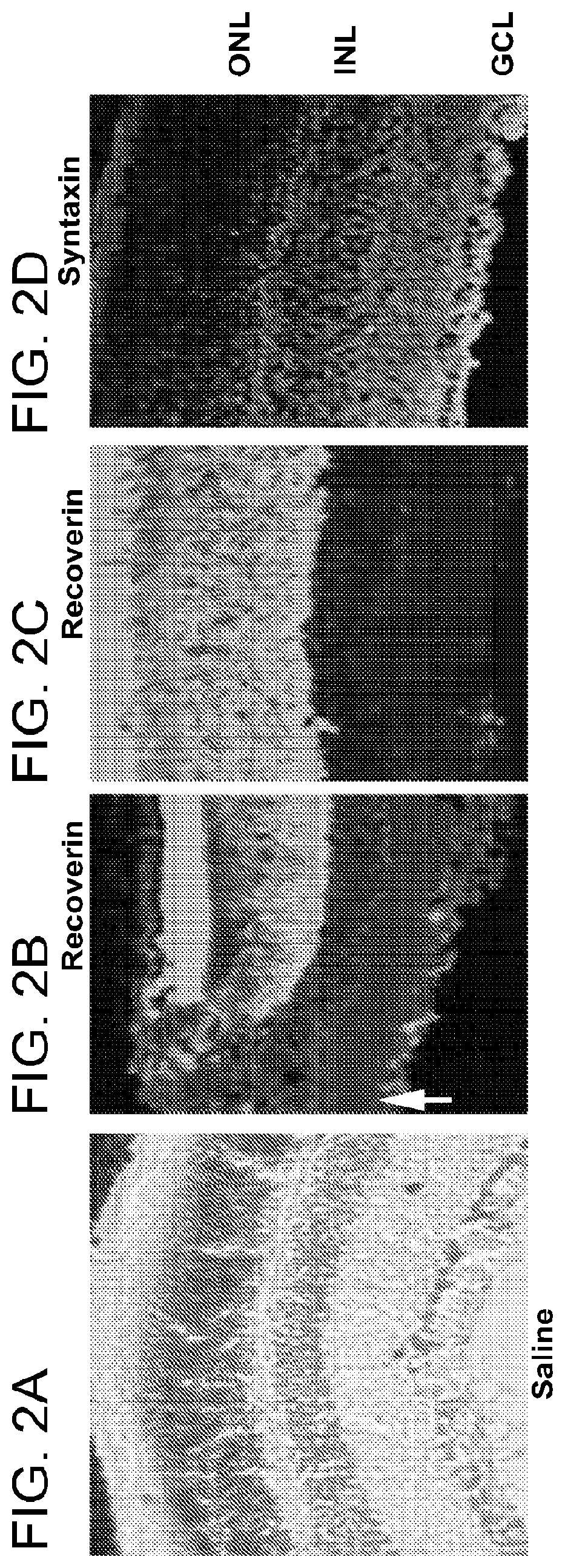 Alpha-aminoadipate for treatment of vision loss and restoring sight