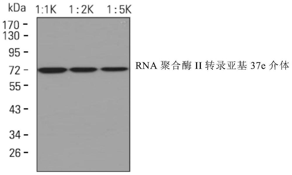 A kind of monoclonal antibody of RNA polymerase II transcriptional subunit 37e mediator and its application