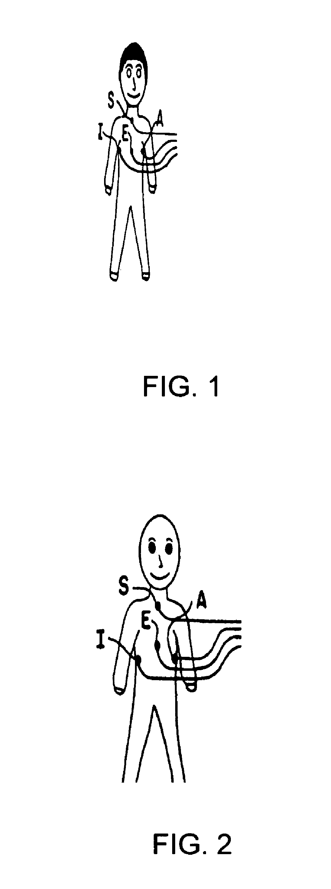 Wireless electrode arrangement and method for patient monitoring via electrocardiography