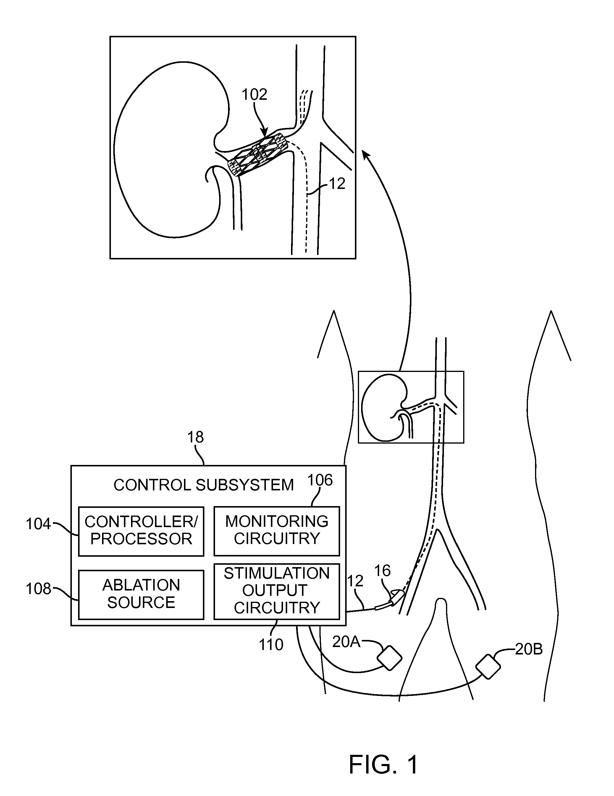 System and method of using evoked compound action potentials to minimize vessel trauma during nerve ablation
