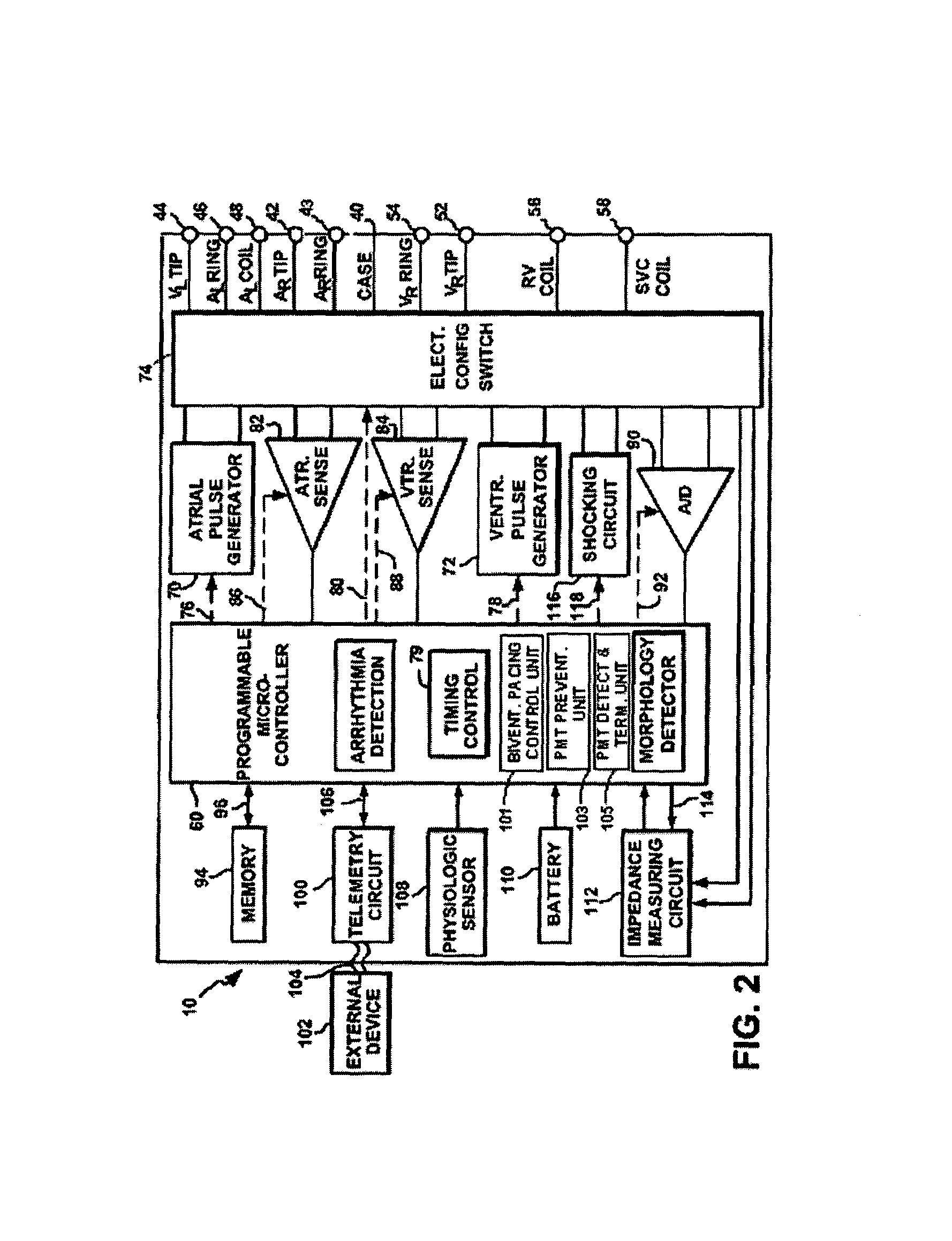System and methods for preventing, detecting, and terminating pacemaker mediated tachycardia in biventricular implantable cardiac stimulation device