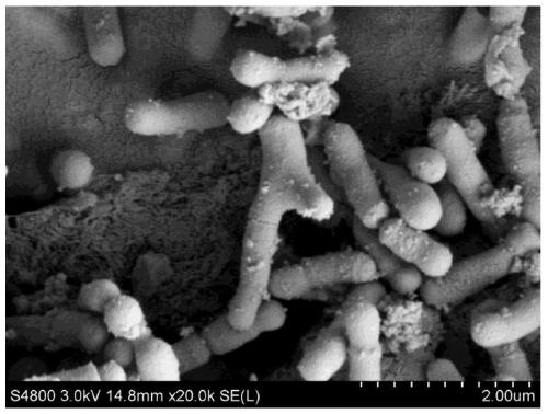 A bifidobacterium strain that can be used for selenium-enriched culture and its active protein and application