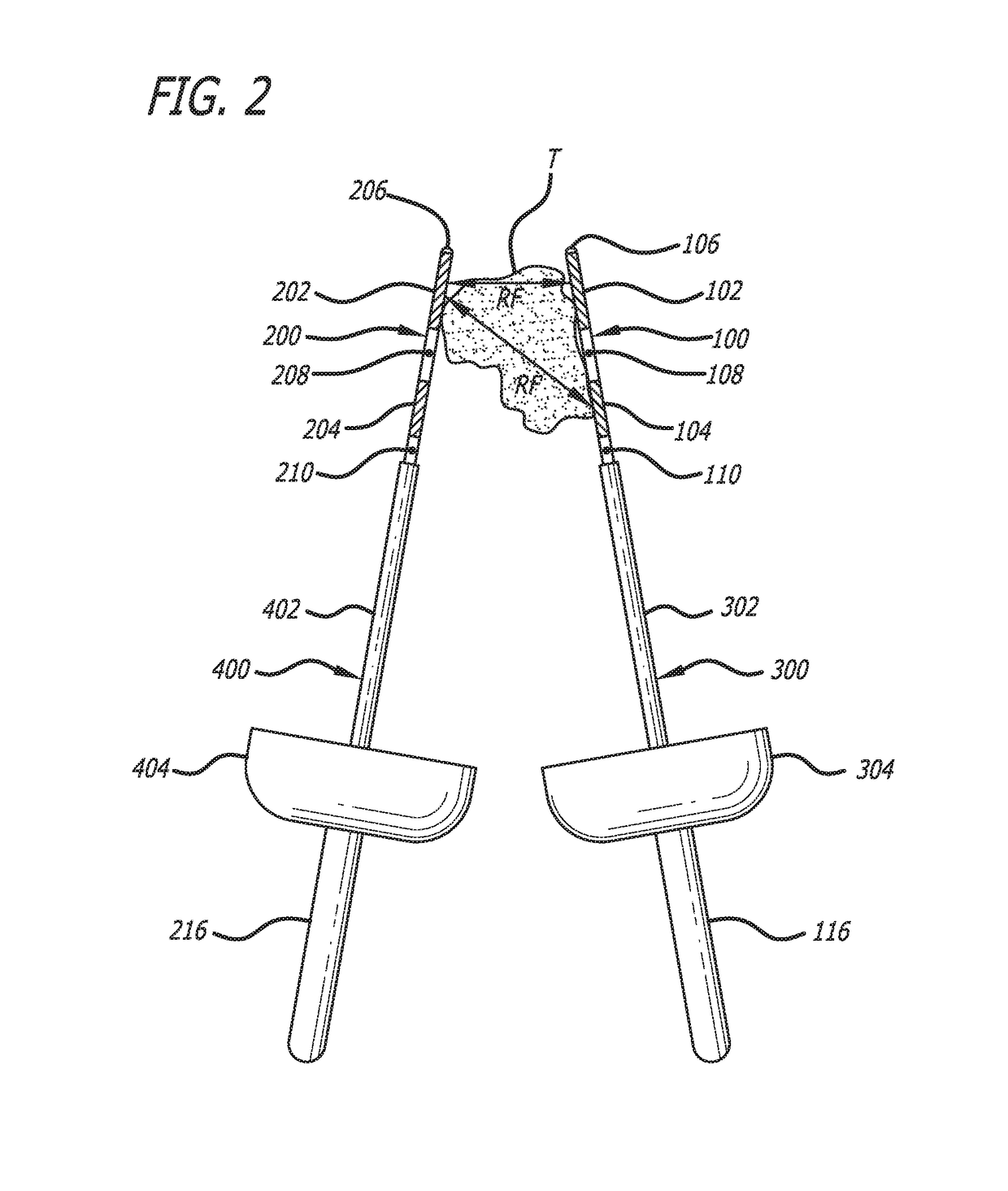 Apparatus for ablation of body tissue and method of use thereof