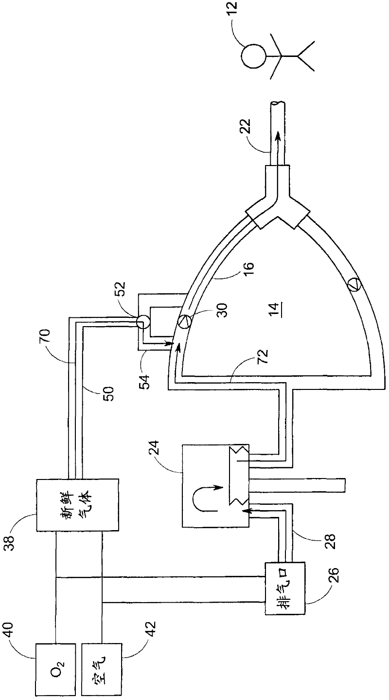 System and method for providing mechanical ventilation support to a patient