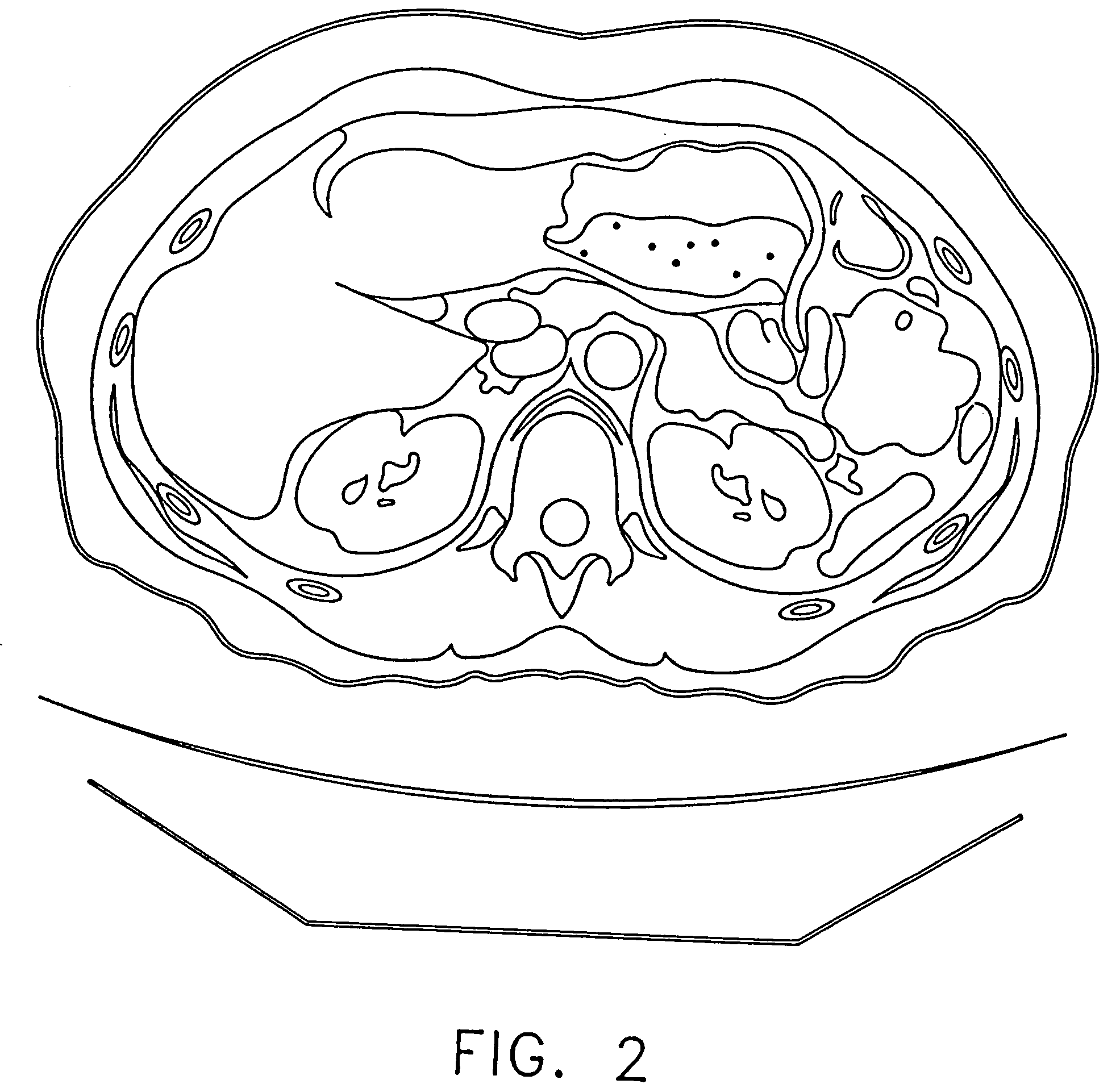 Anatomical visualization system