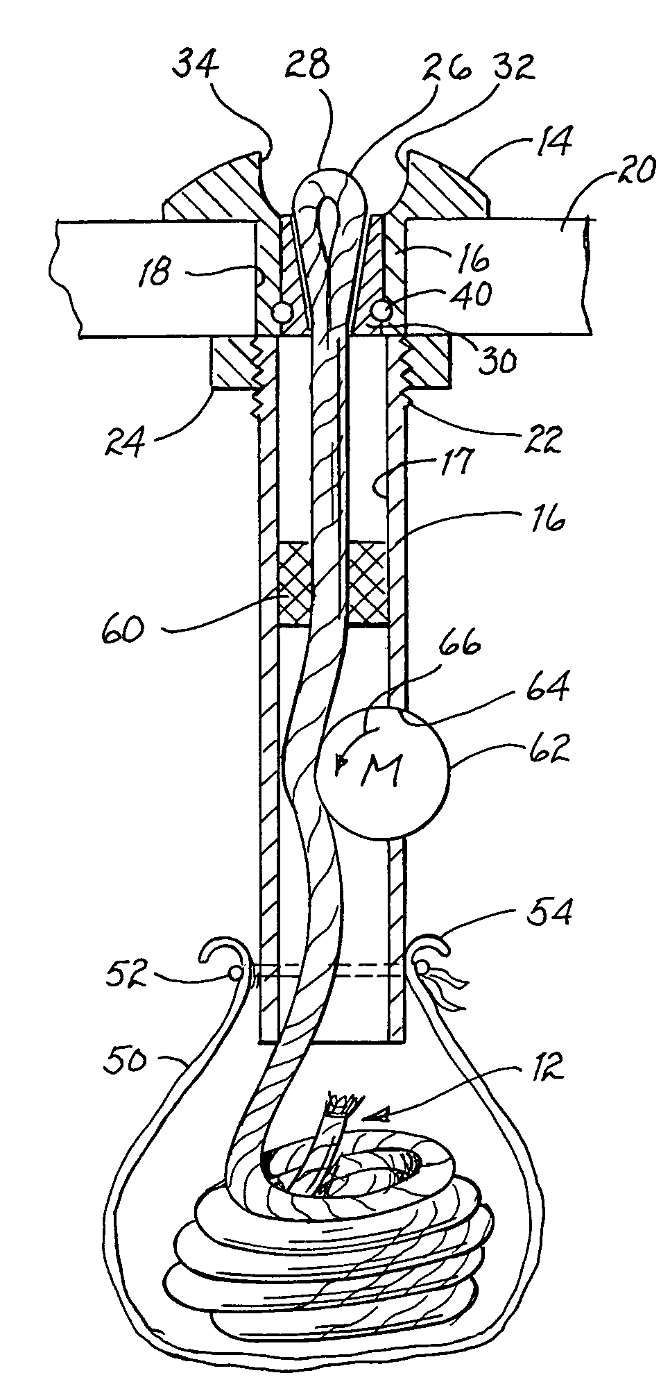 Mooring line retracting/extracting fitting
