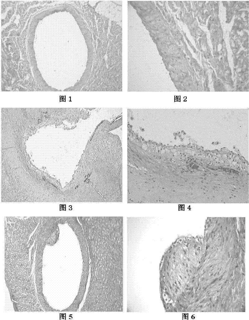 Multibacterial starter and multibacterial fermented milk product for anti-atherosclerosis and production method thereof