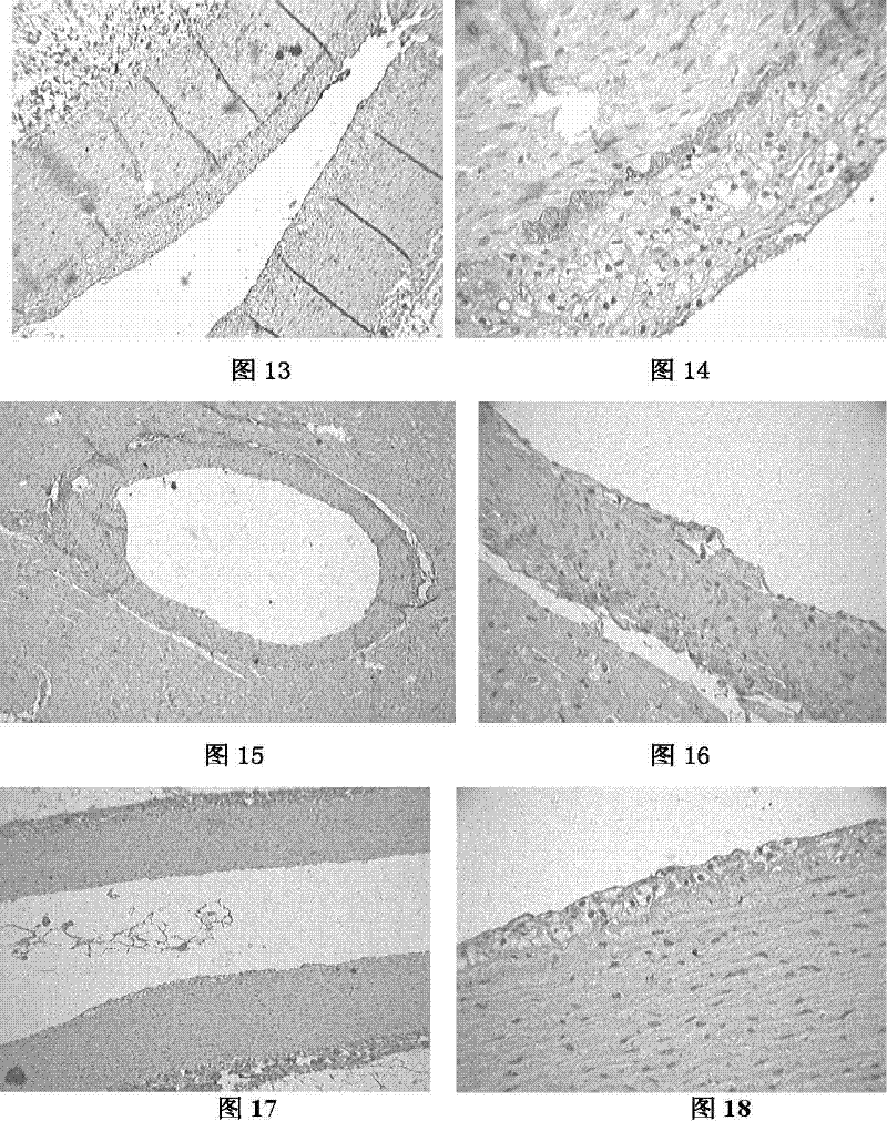 Multibacterial starter and multibacterial fermented milk product for anti-atherosclerosis and production method thereof