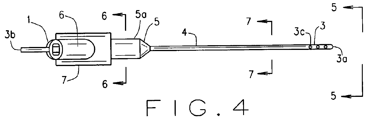 Expandable intra-venous catheter for a faster intra-venous fluid challenge