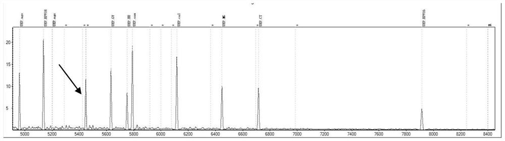 Primer composition for detecting genital tract pathogens through MALDI-TOF MS and application