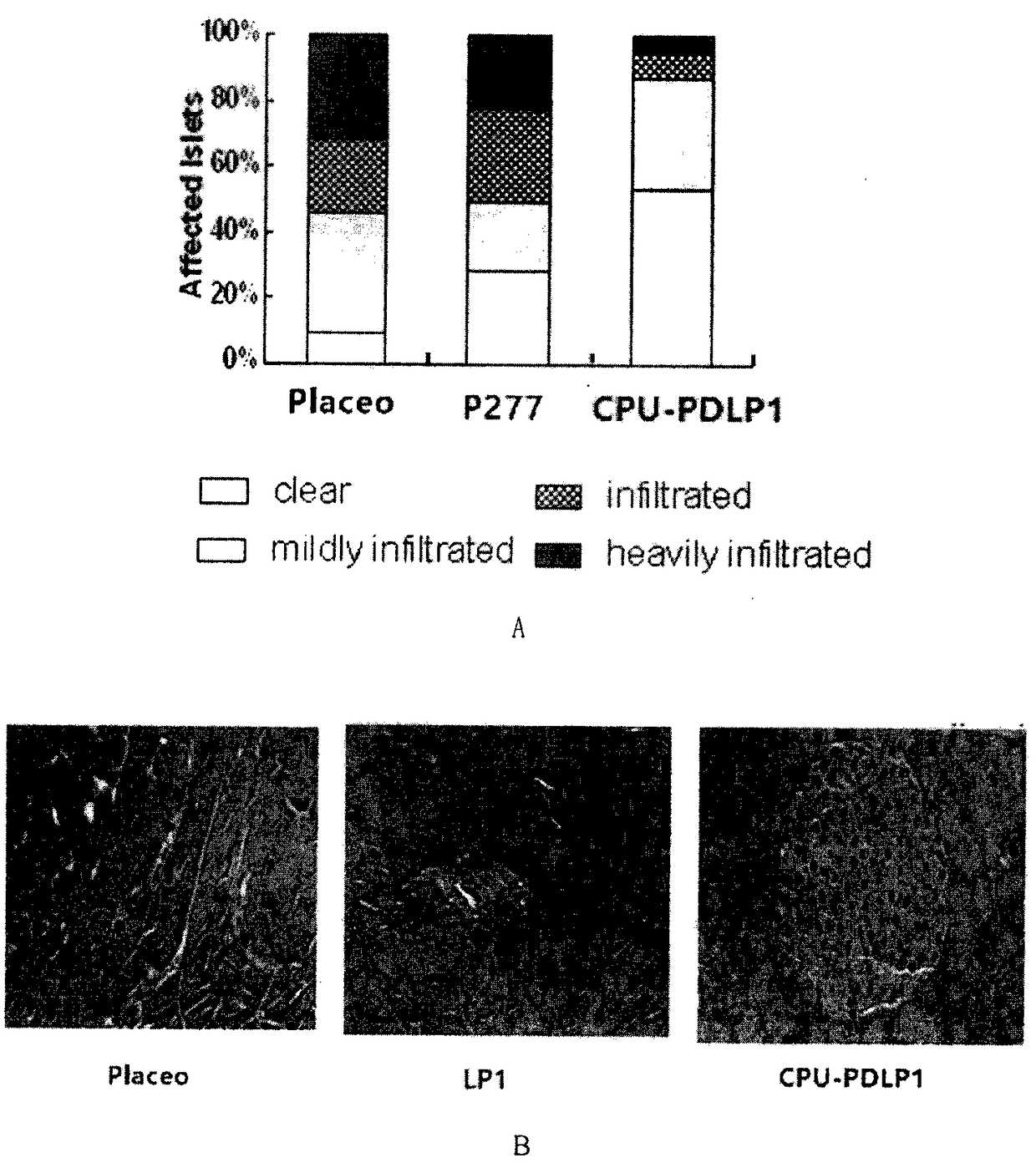 Linear 33 peptide capable of preventing and treating type 1 diabetes and having function of protecting pancreatic beta cells and application of linear 33 peptide