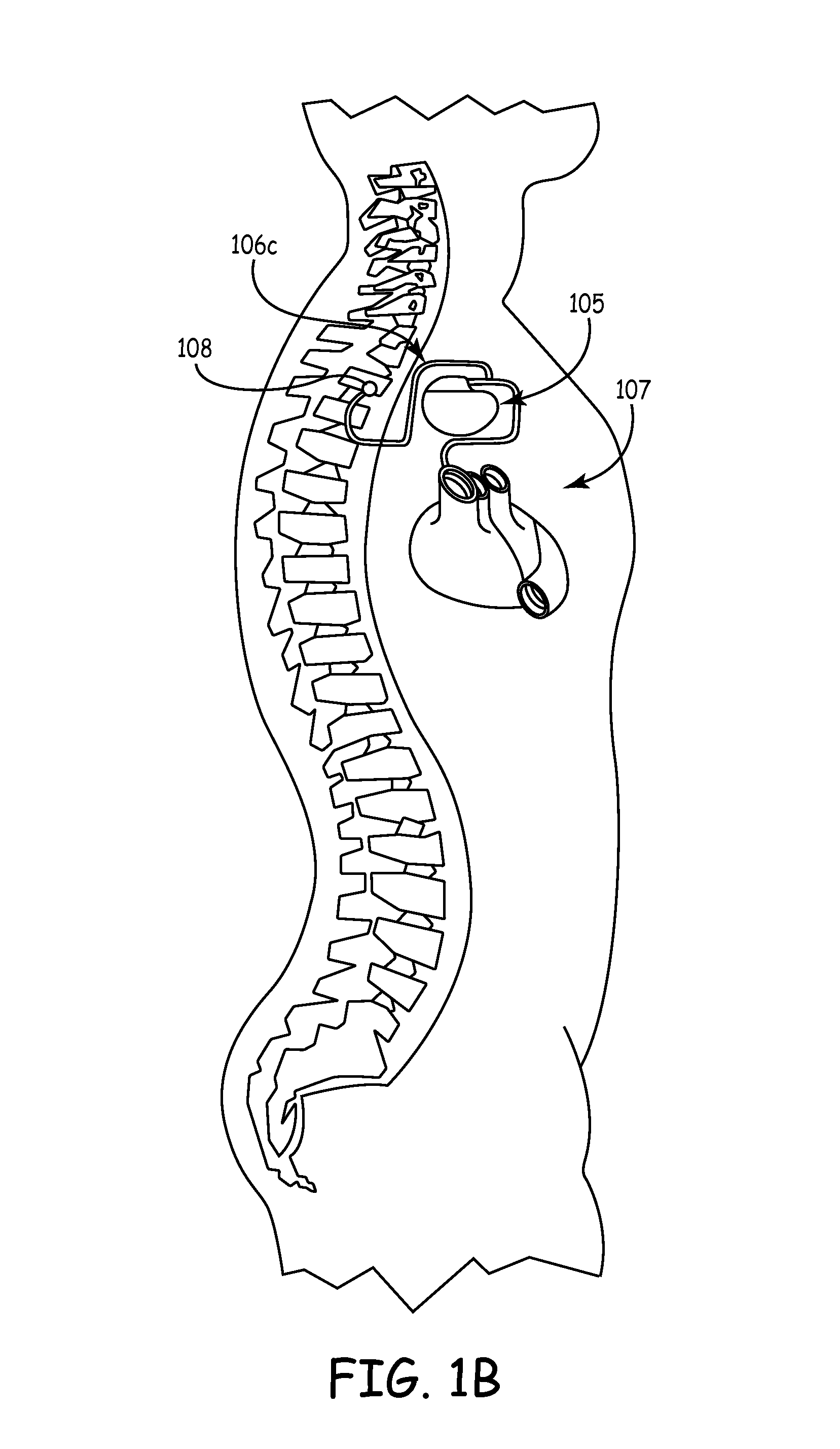 Methods and apparatus for sensing cardiac activity via neurological stimulation therapy system or medical electrical lead