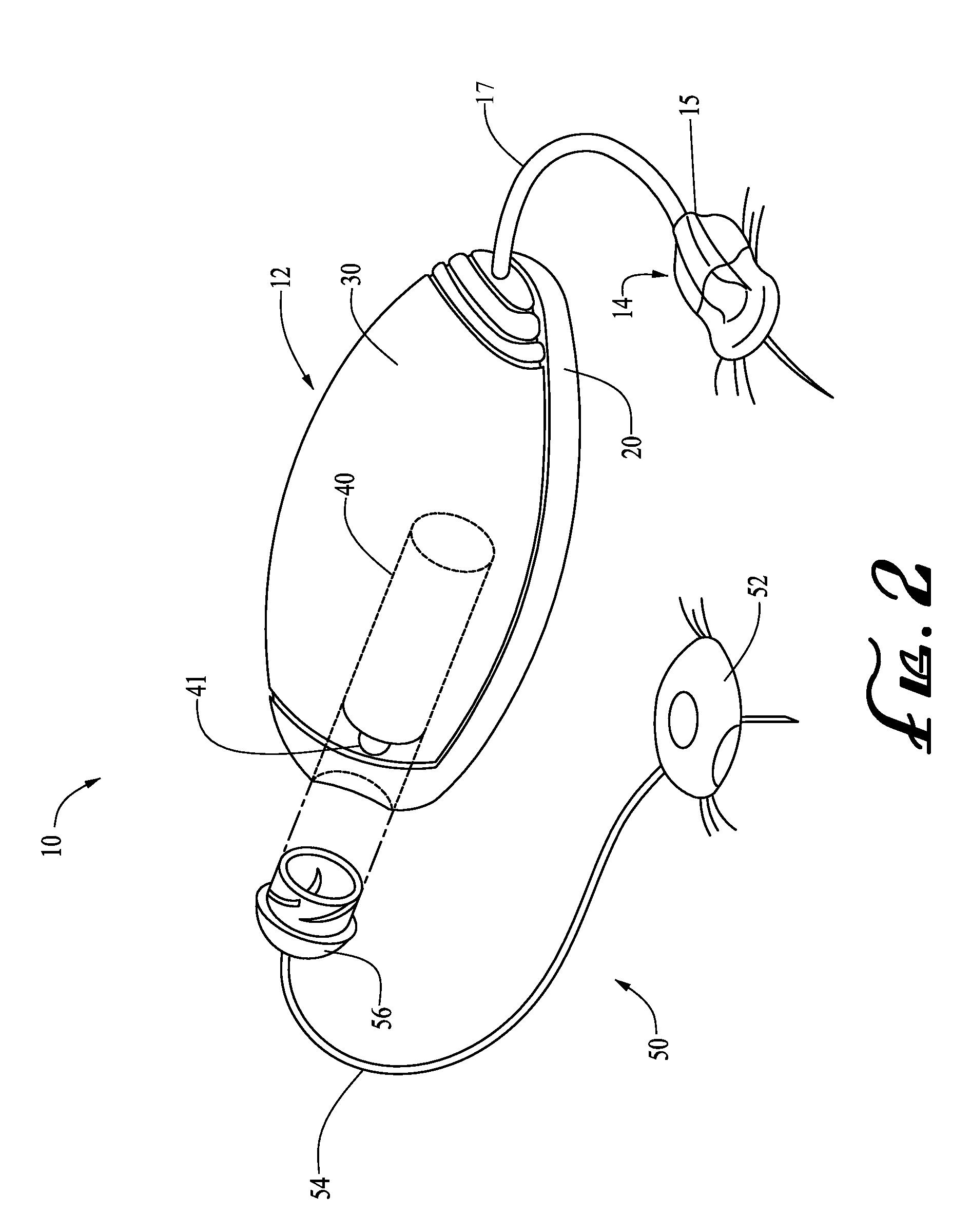 Insertion device systems and methods