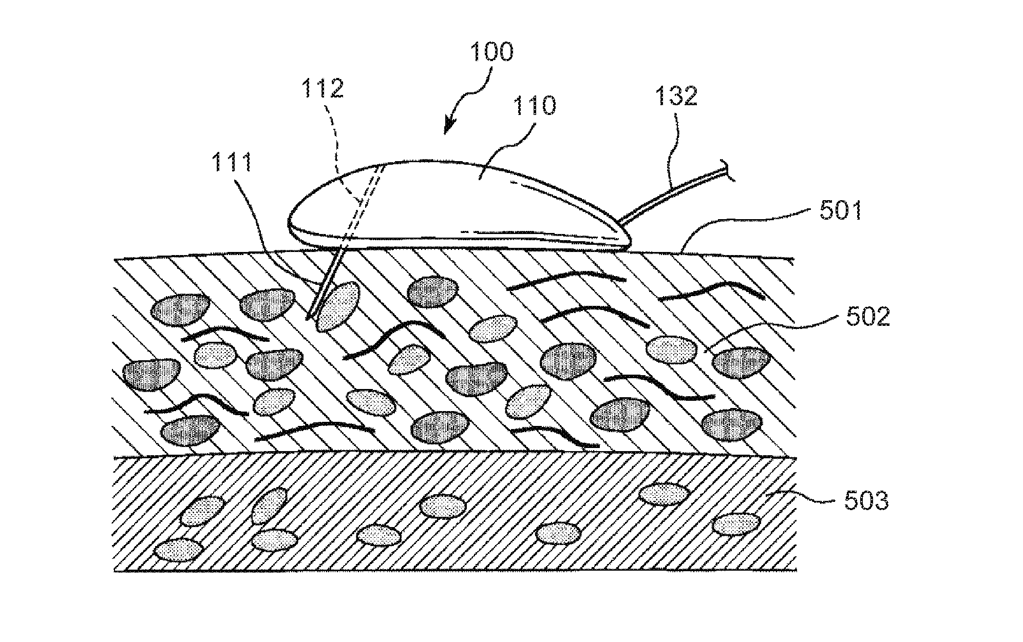 Detection method using detection element, detection element, measurement device, and insulin supply device