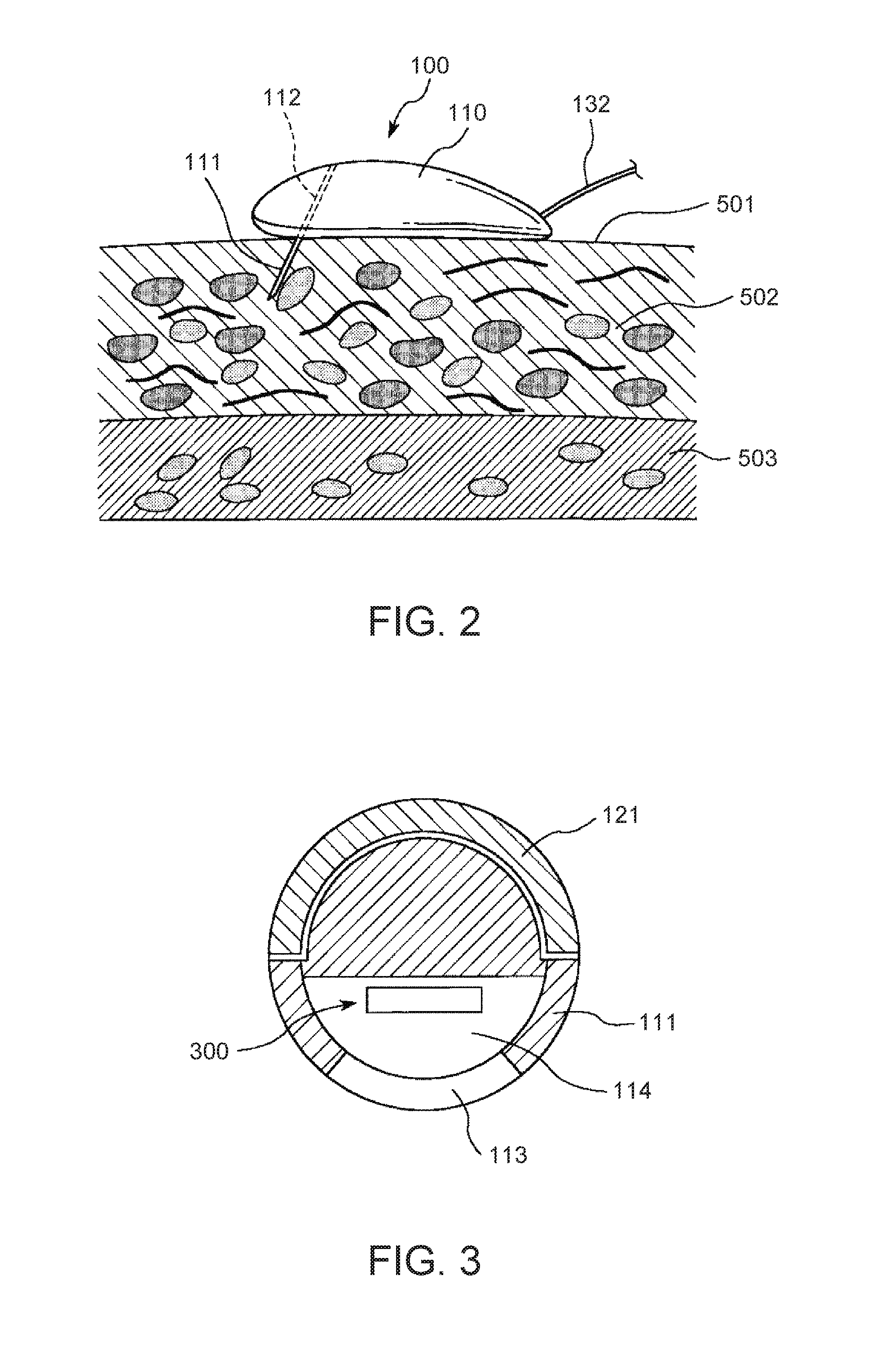 Detection method using detection element, detection element, measurement device, and insulin supply device