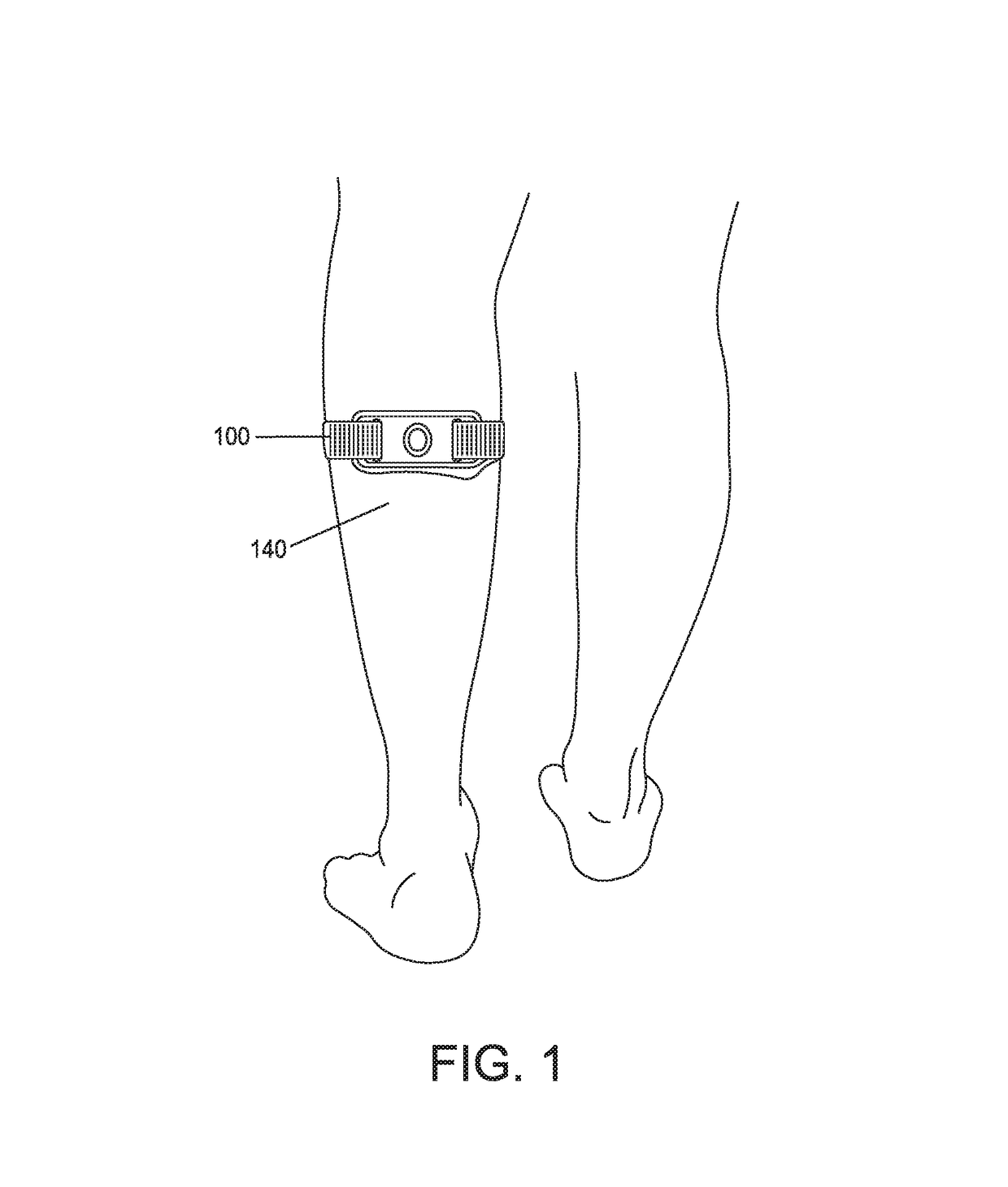 Measuring the “on-skin” time of a transcutaneous electrical nerve stimulator (TENS) device in order to minimize skin irritation due to excessive uninterrupted wearing of the same