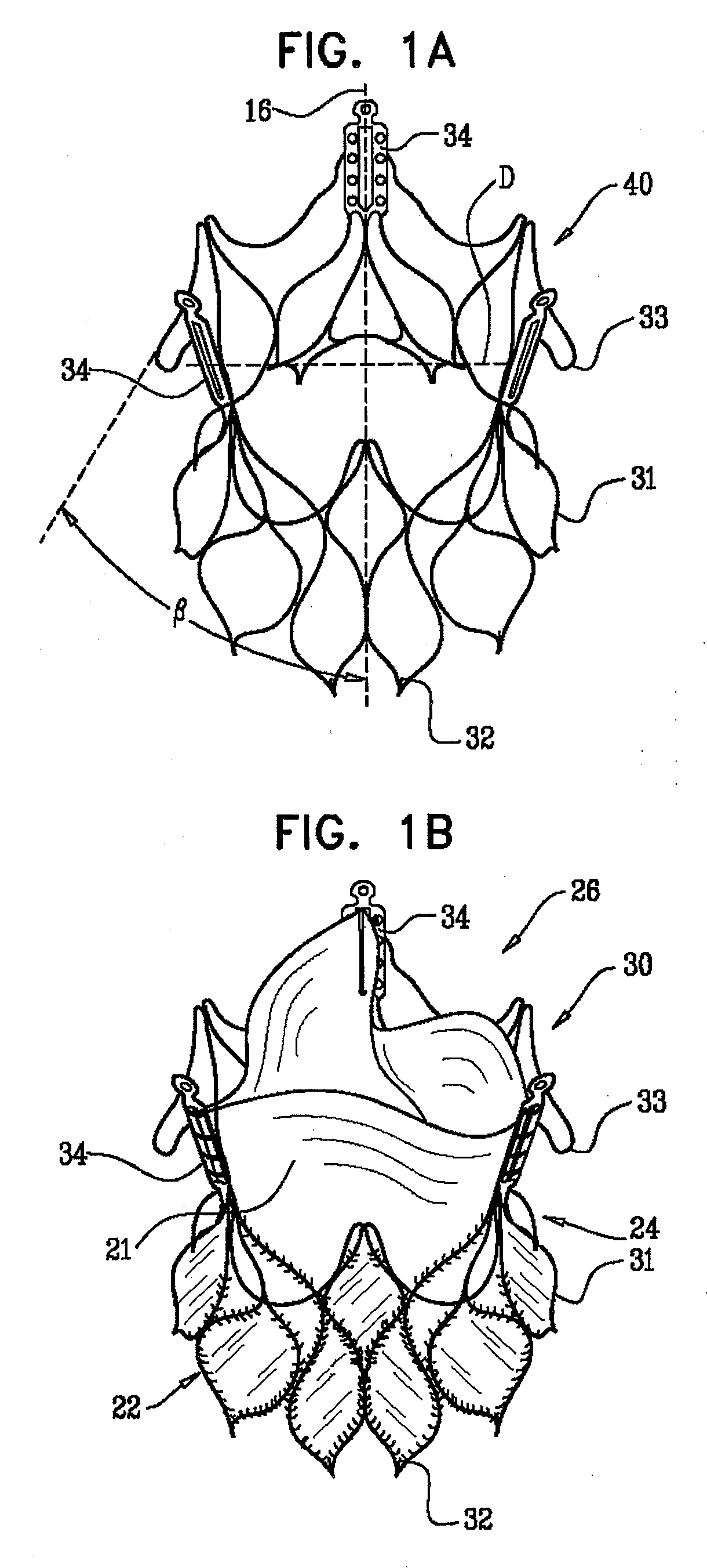 Prosthetic heart valve for transfemoral delivery