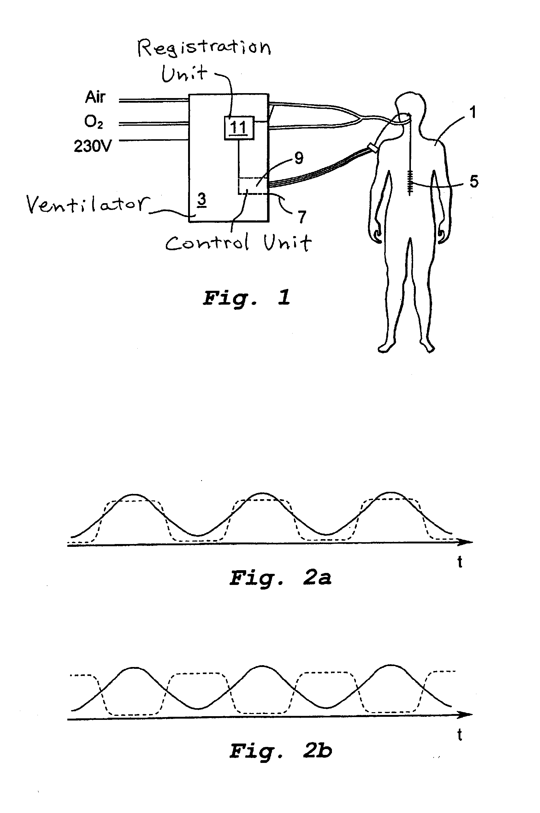 Emg-controlled ventilator and method for the operation thereof
