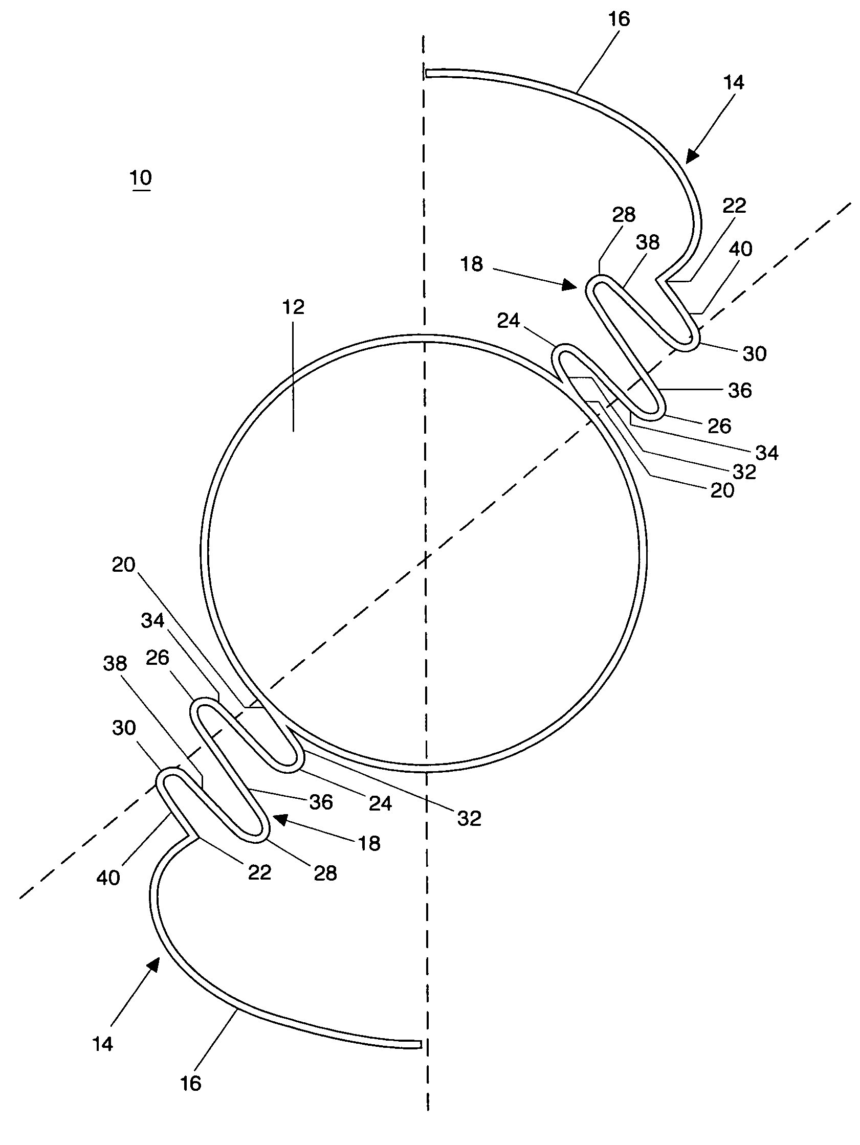 Accommodating intraocular lens implant