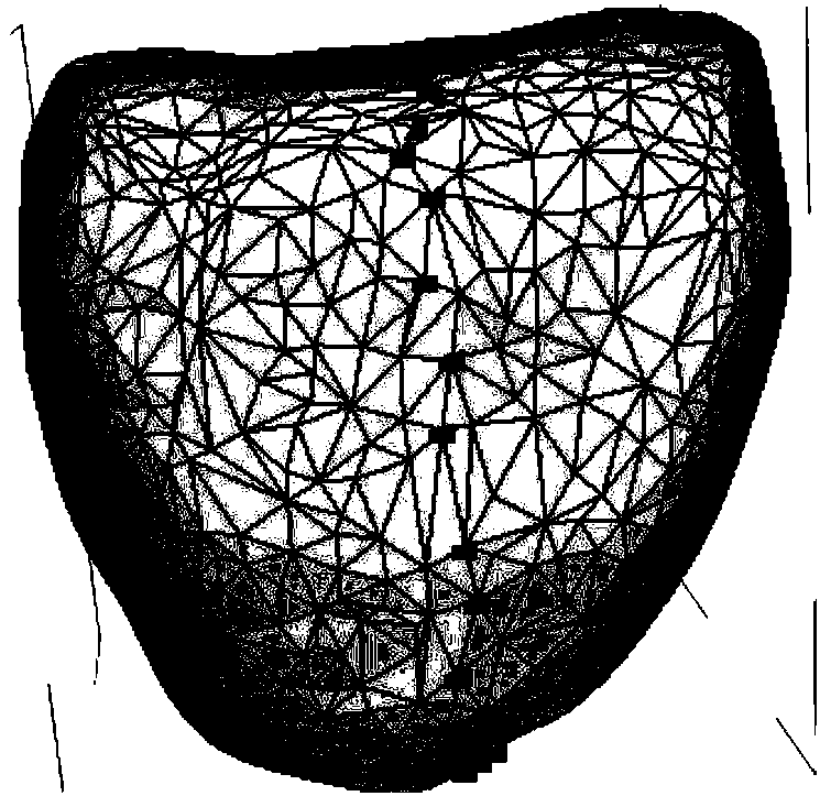 Automatic recognition algorithm for feature points of tooth models based on local coordinates