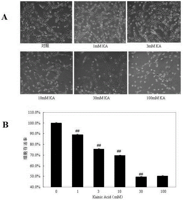 Application of docosahexaenoic acid ethyl ester in preparation of drug for improving excitatory neural toxicity