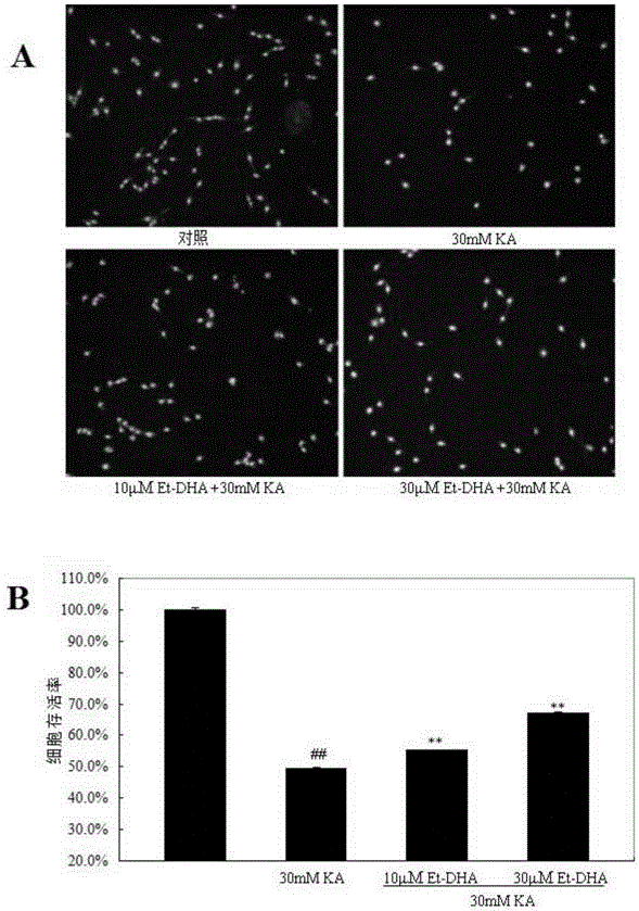 Application of docosahexaenoic acid ethyl ester in preparation of drug for improving excitatory neural toxicity