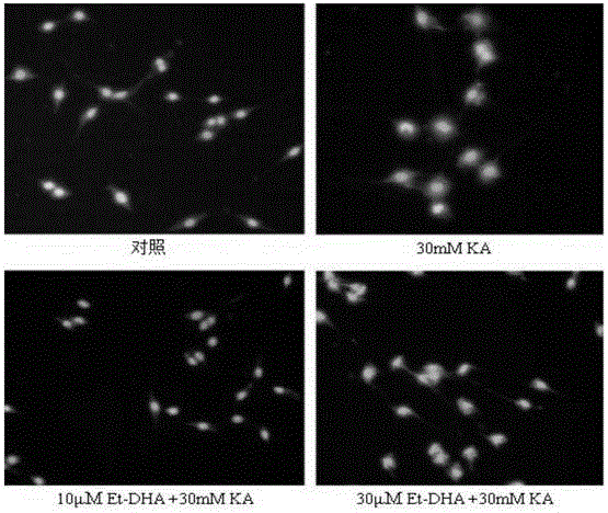 Application of docosahexaenoic acid ethyl ester in preparation of drug for improving excitatory neural toxicity