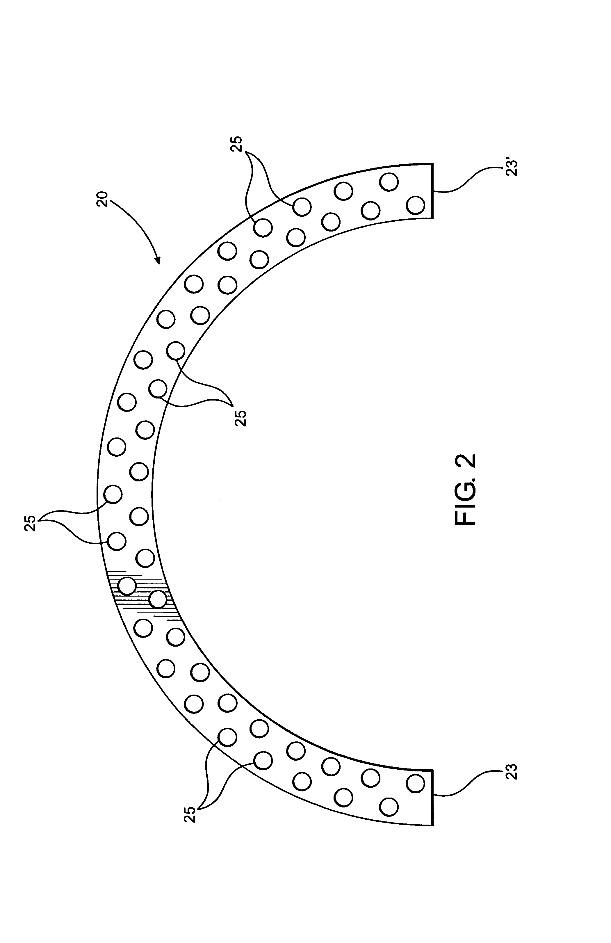 External fixator assembly