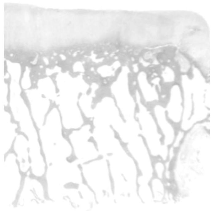 A biomimetic multilayer collagen scaffold for cartilage repair and its preparation method