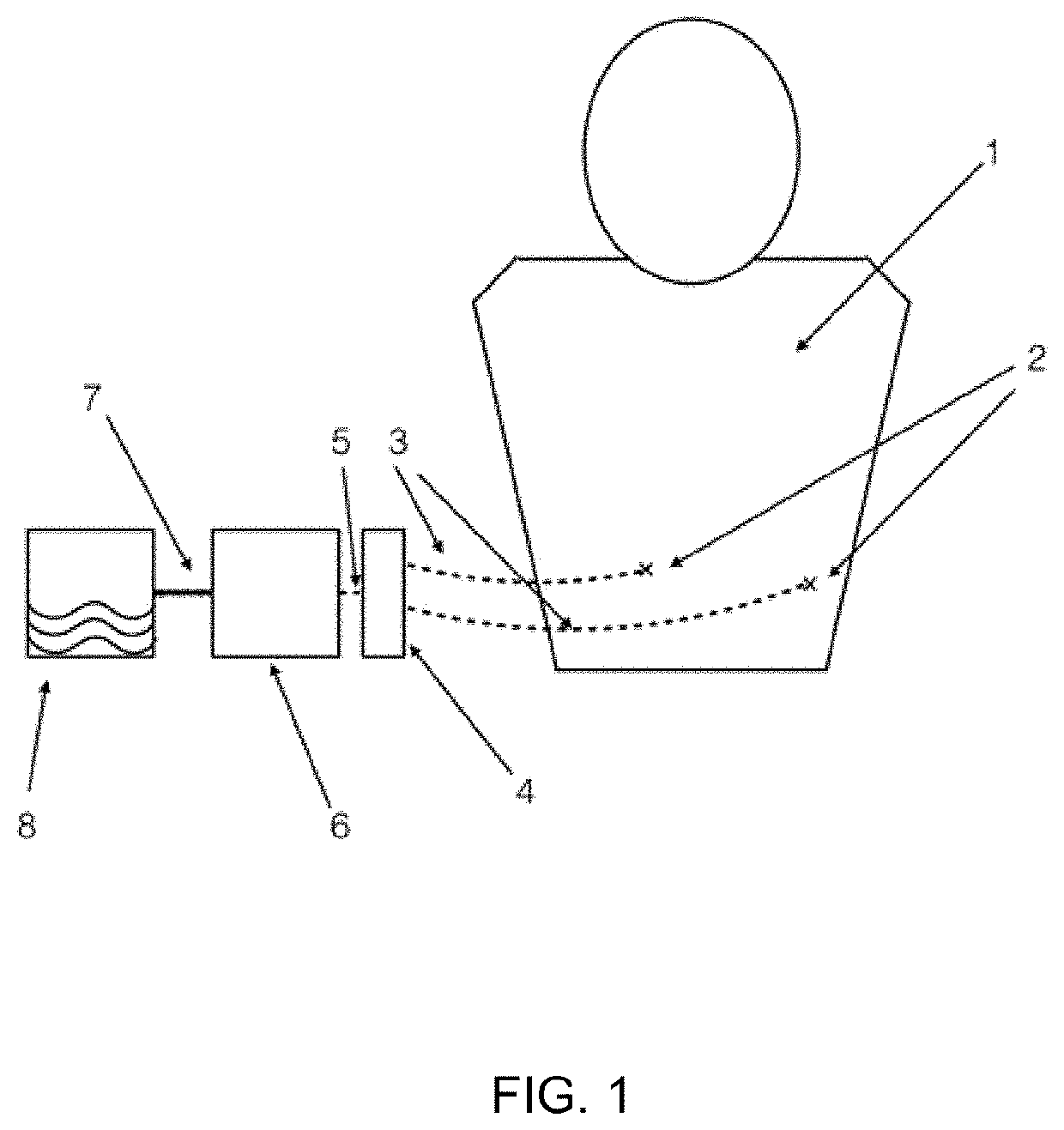 Portable device with disposable reservoir for collection of internal fluid after surgery from a plurality of sites simultaneously