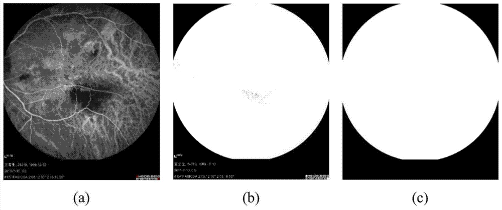 Fluorescein contrast fundus image extraction method based on ngc-acm