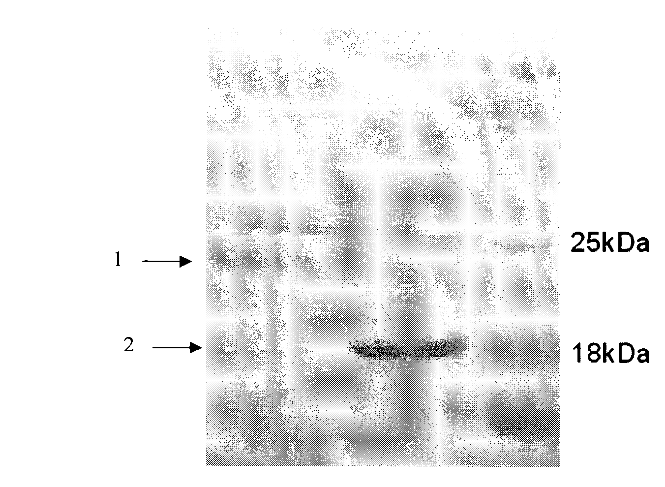 Chimeric antibody and immunocyte