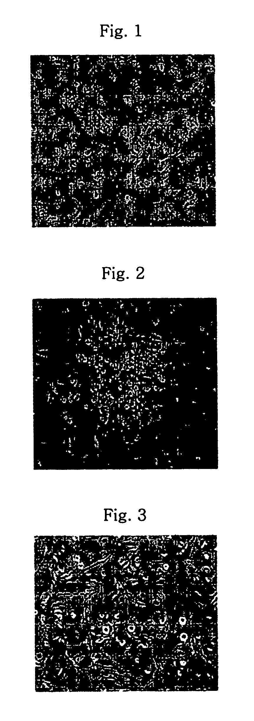 Method of isolating and culturing mesenchymal stem cell derived from umbilical cord blood