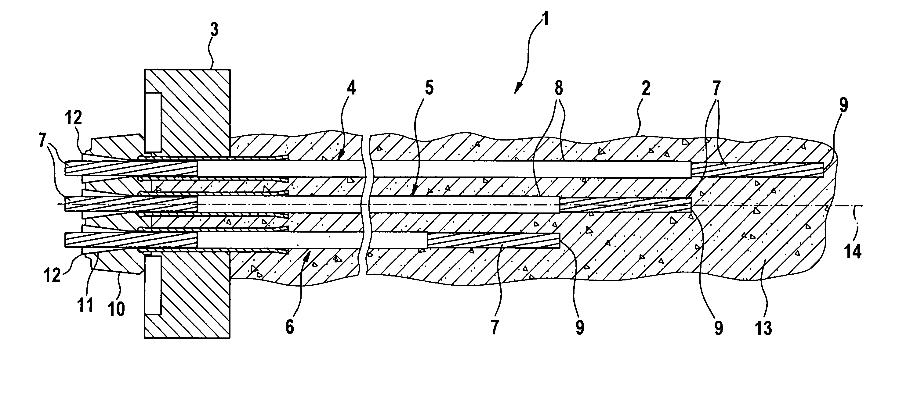 Method and arrangement for stressing a staggered anchorage