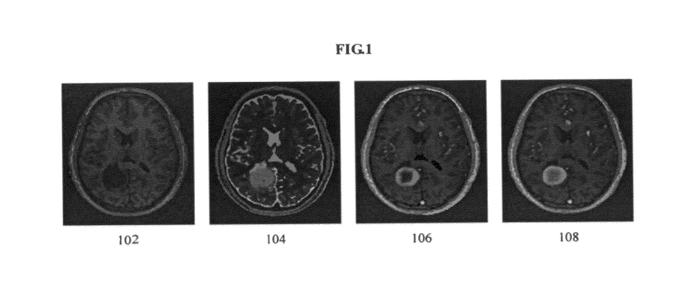 Method and system for brain tumor segmentation in multi-parameter 3D MR images via robust statistic information propagation