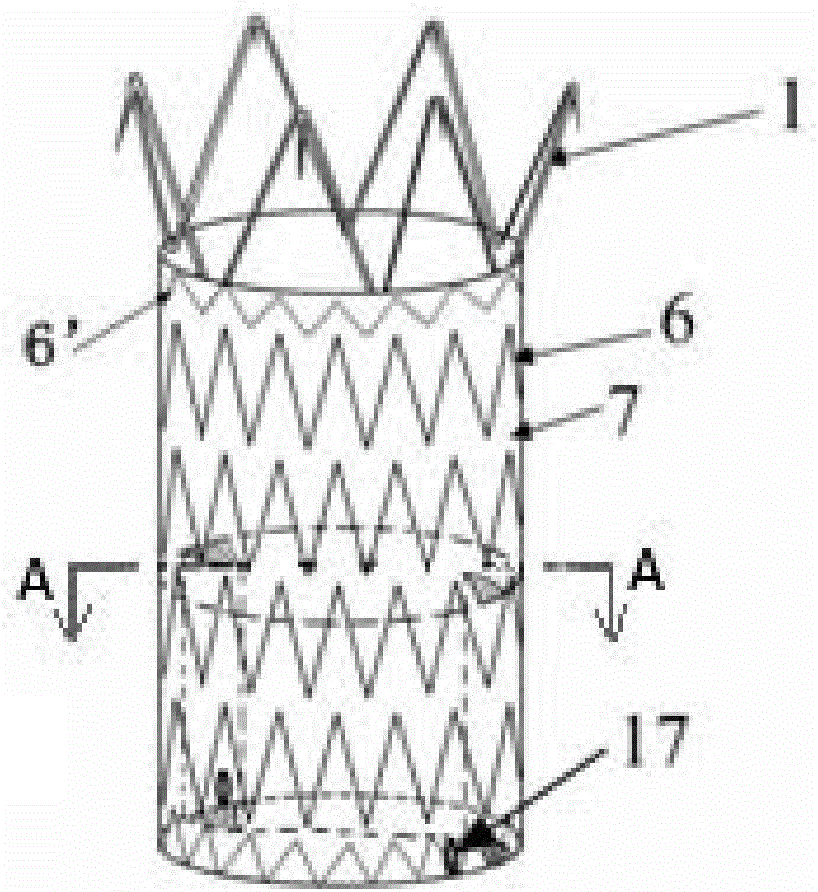 Combined abdominal aorta covered stent system and utilization method thereof