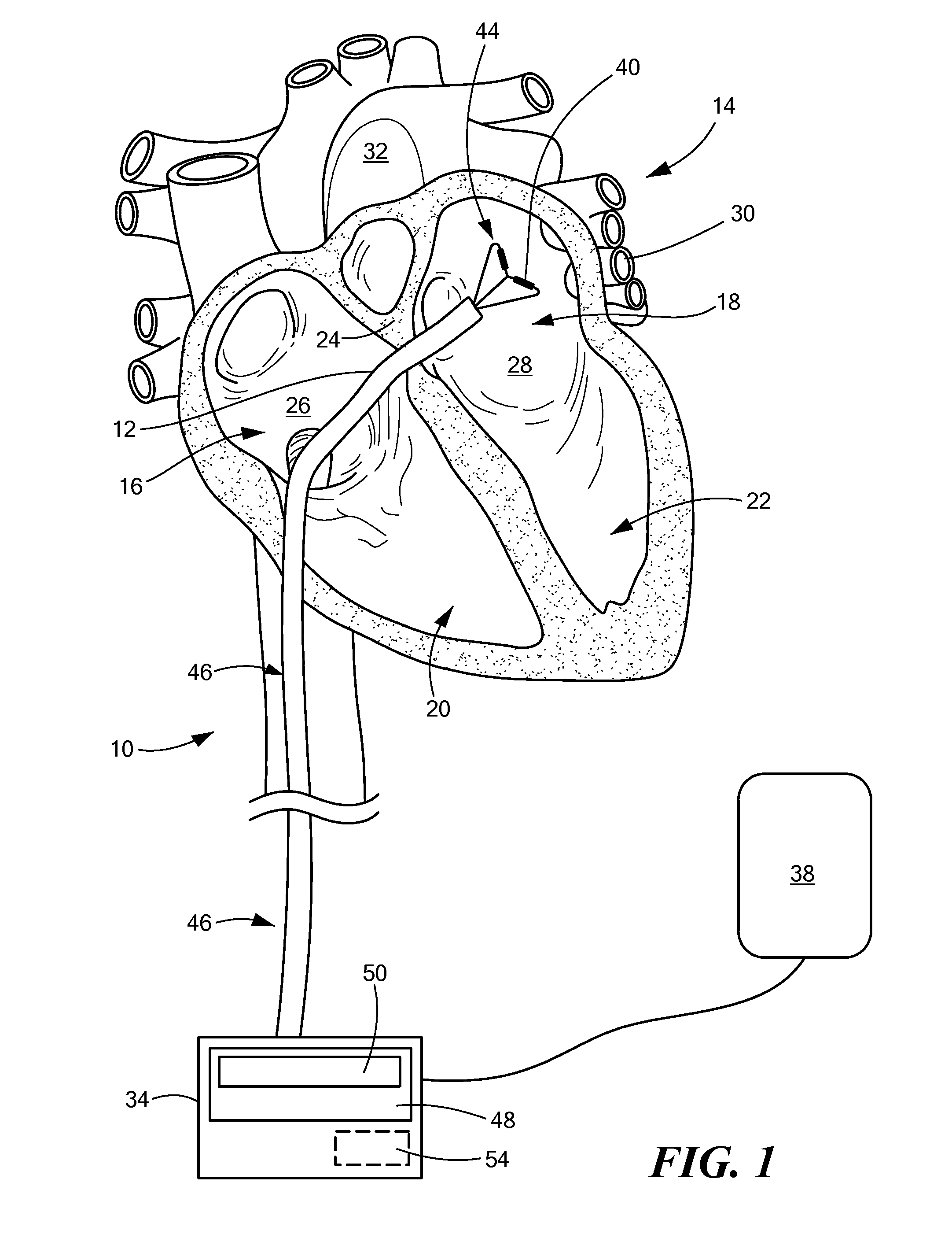 Controlled RF energy in a multi-electrode catheter