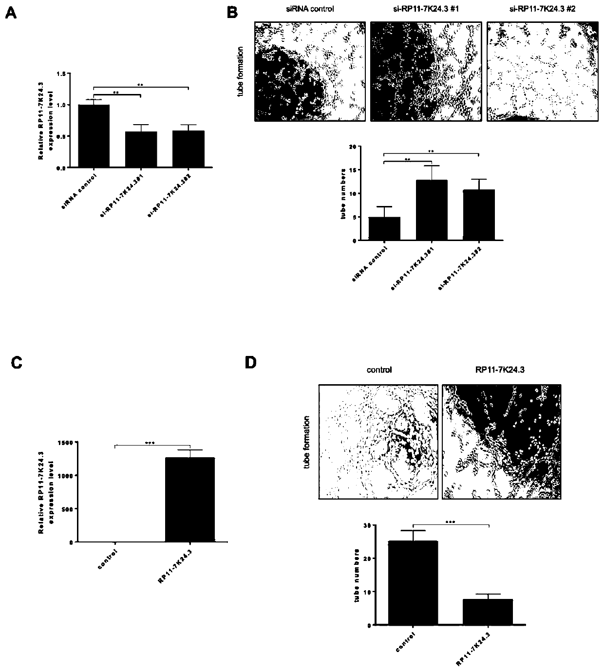 Long non-coding RNA (ribonucleic acid) and application thereof in diagnosing/treating cervical cancer