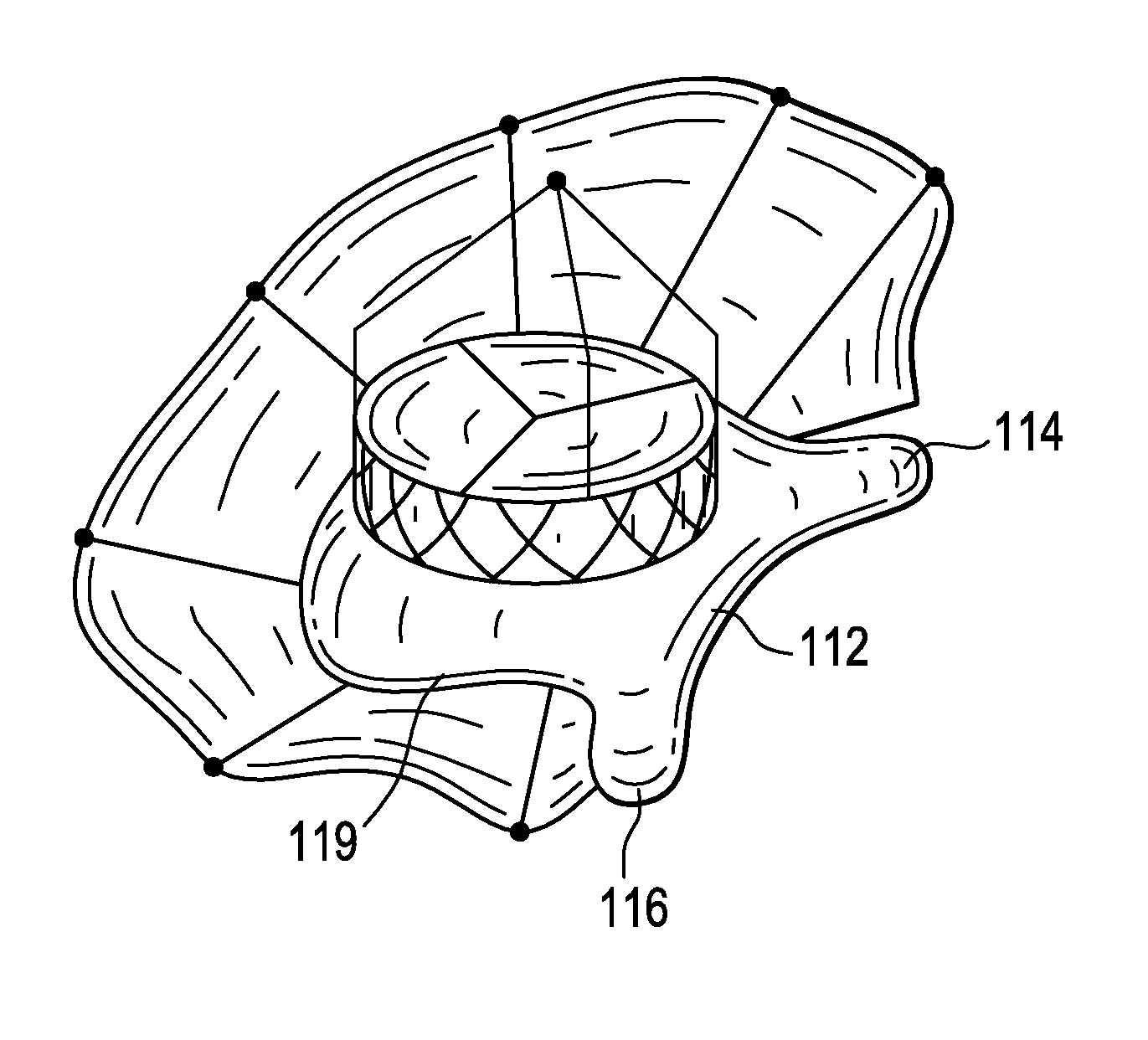 Inflatable Annular Sealing Device for Prosthetic Mitral Valve