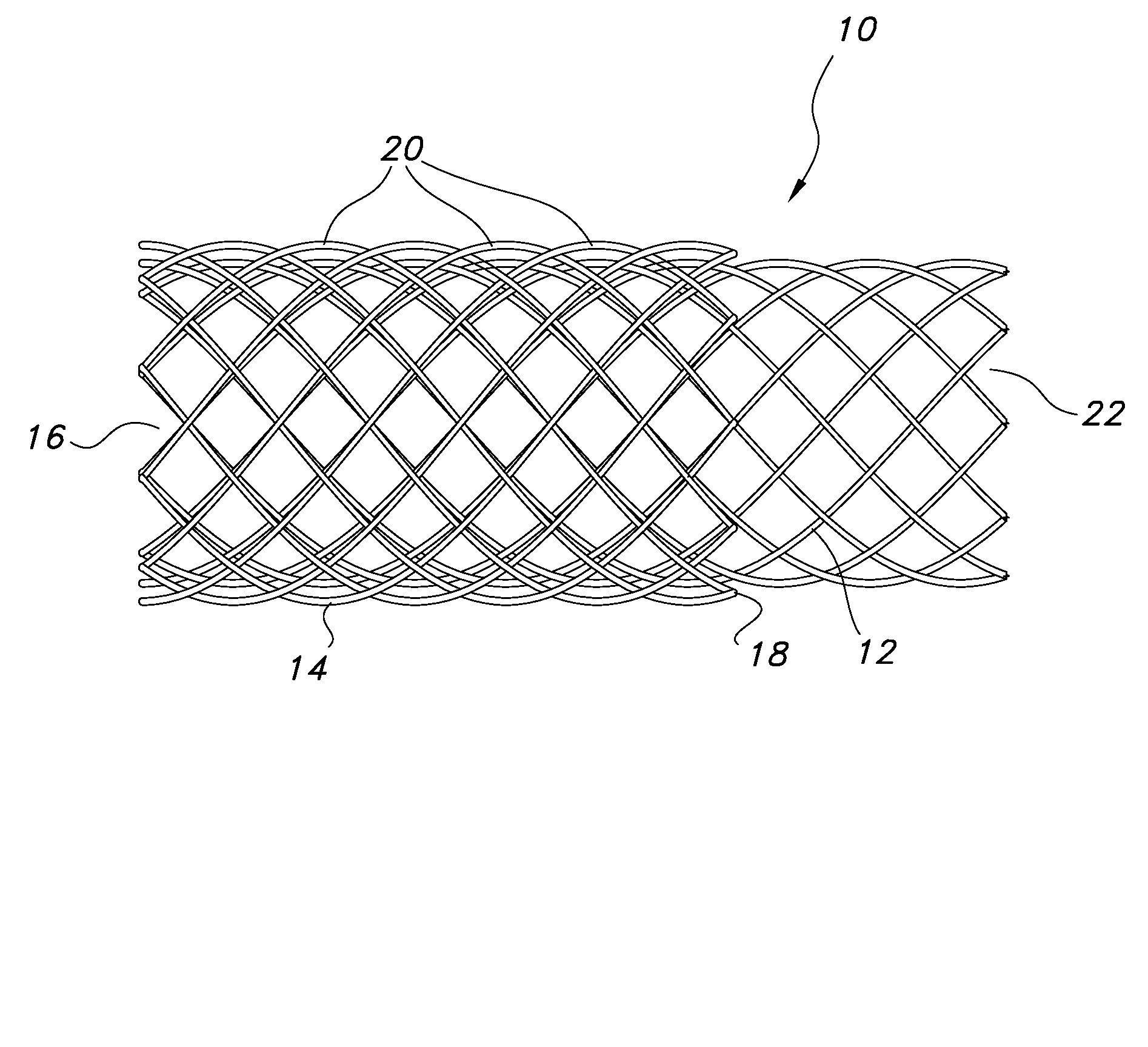 Continuous double layered stent for migration resistance