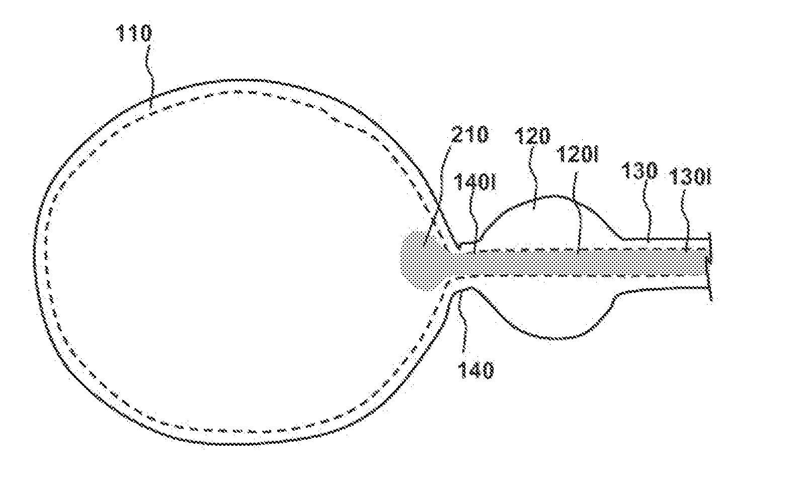 Methods, compositions and kits for performing anastomosis procedures in conjunction with a radical prostatectomy procedure