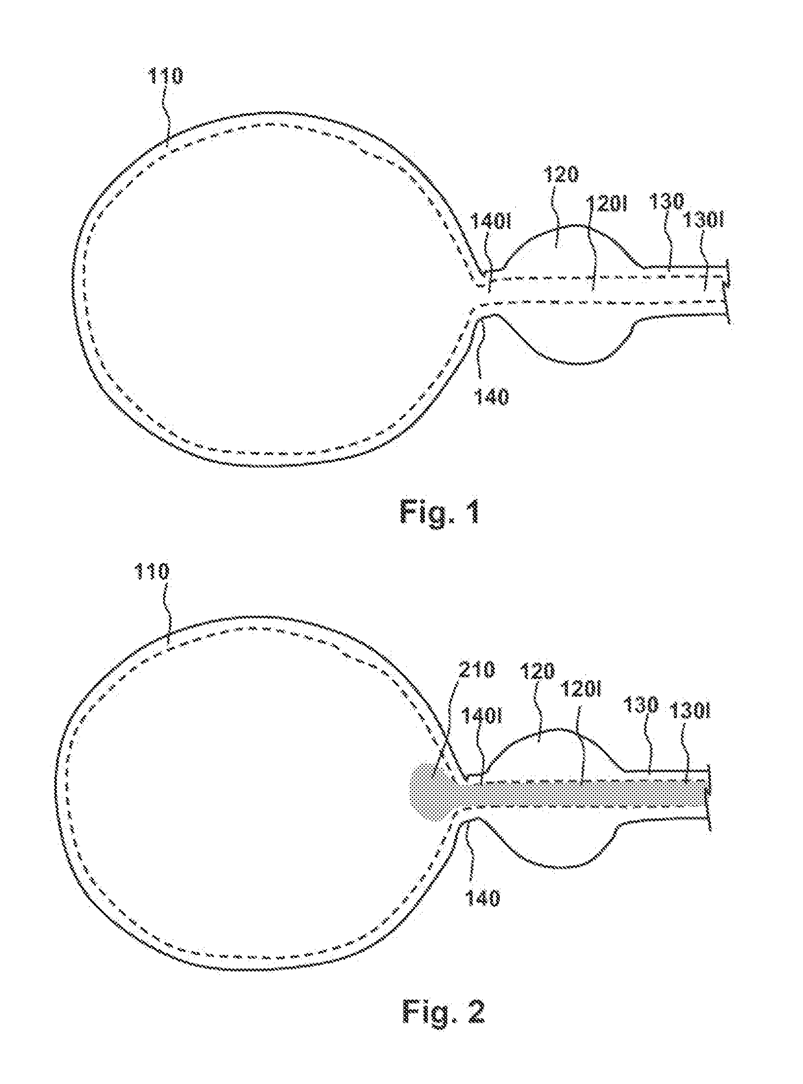 Methods, compositions and kits for performing anastomosis procedures in conjunction with a radical prostatectomy procedure