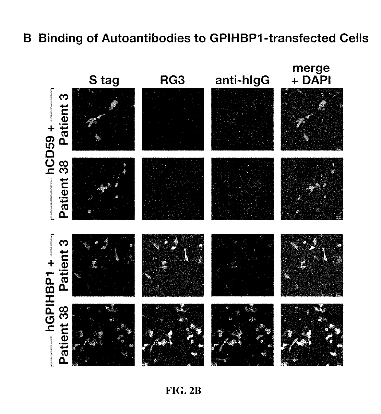 Methods and compositions for treating hypertriglyceridemia